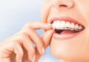 Pamirškite ilgas eiles pas gydytoją ortodontą – „Šypsenos akademijos“ komandą papildė net 15 metų patirtį sukaupusi gydytoja ortodontė